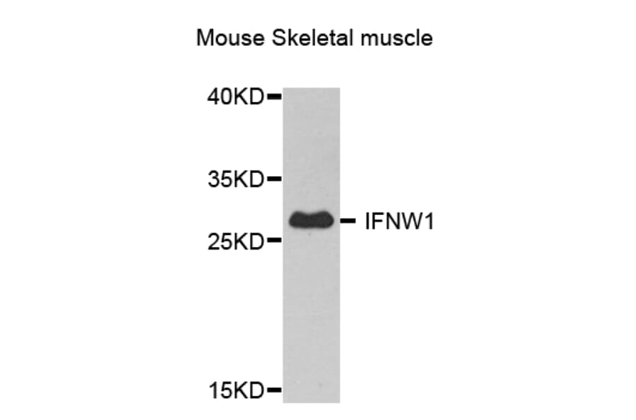 Western Blot - Anti-IFNW1 Antibody (A8125) - Antibodies.com