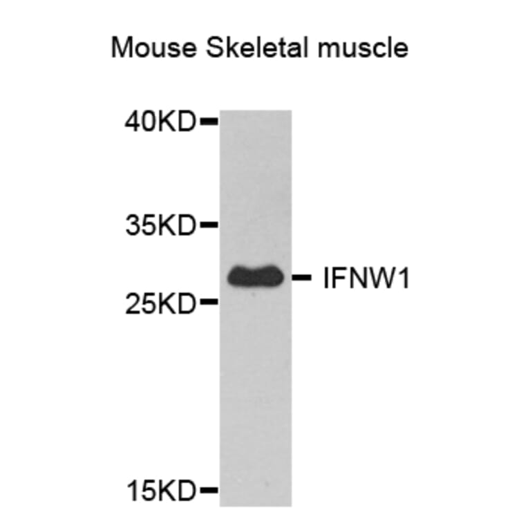 Western Blot - Anti-IFNW1 Antibody (A8125) - Antibodies.com