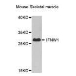 Western Blot - Anti-IFNW1 Antibody (A8125) - Antibodies.com