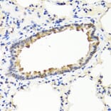 Immunohistochemistry - Anti-IFNW1 Antibody (A8125) - Antibodies.com