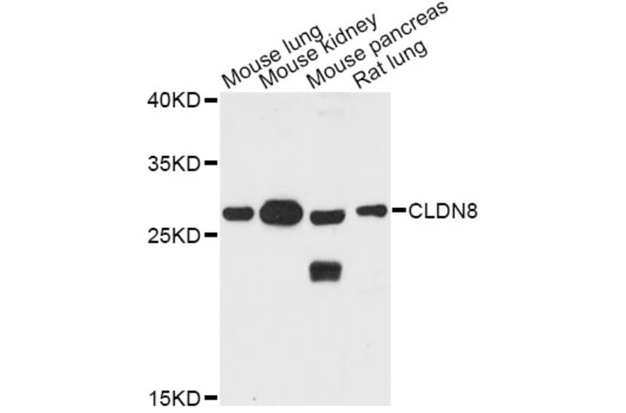 Western Blot - Anti-CLDN8 Antibody (A8174) - Antibodies.com