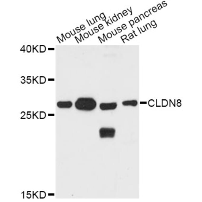 Western Blot - Anti-CLDN8 Antibody (A8174) - Antibodies.com