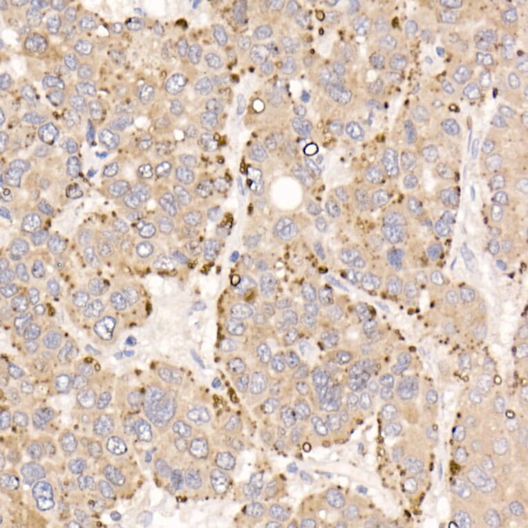 Immunohistochemistry - Anti-METTL7A Antibody (A16930) - Antibodies.com