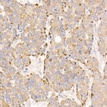 Immunohistochemistry - Anti-METTL7A Antibody (A16930) - Antibodies.com