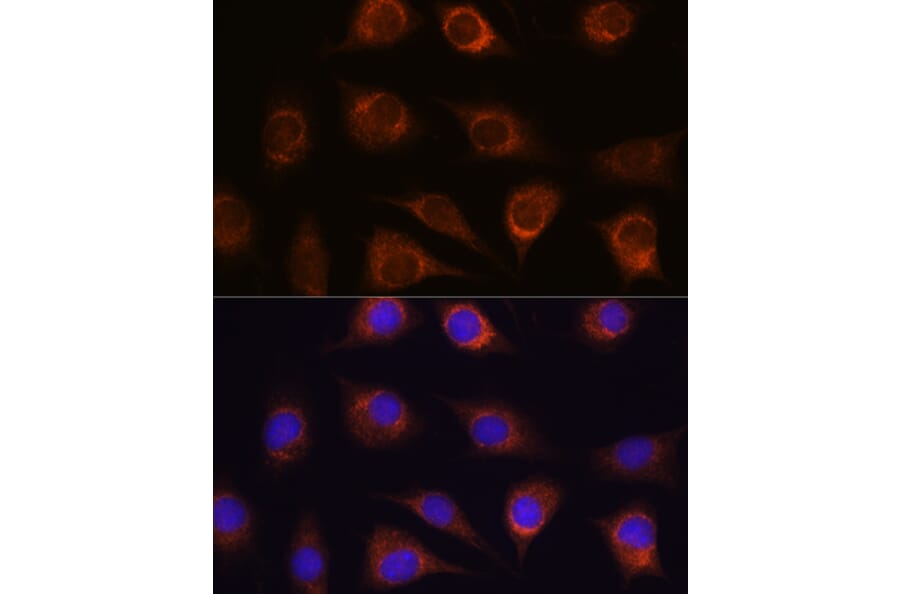 Immunofluorescence - Anti-METTL7A Antibody (A16930) - Antibodies.com