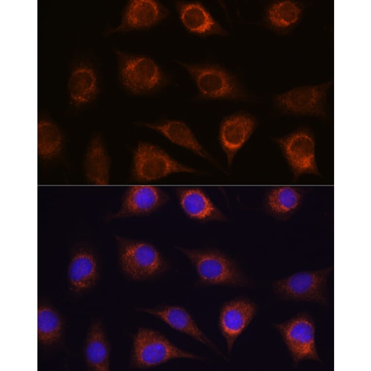 Immunofluorescence - Anti-METTL7A Antibody (A16930) - Antibodies.com