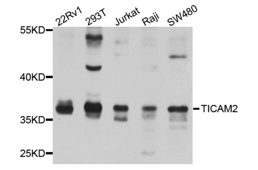 Western Blot - Anti-TICAM2 Antibody (A8292) - Antibodies.com