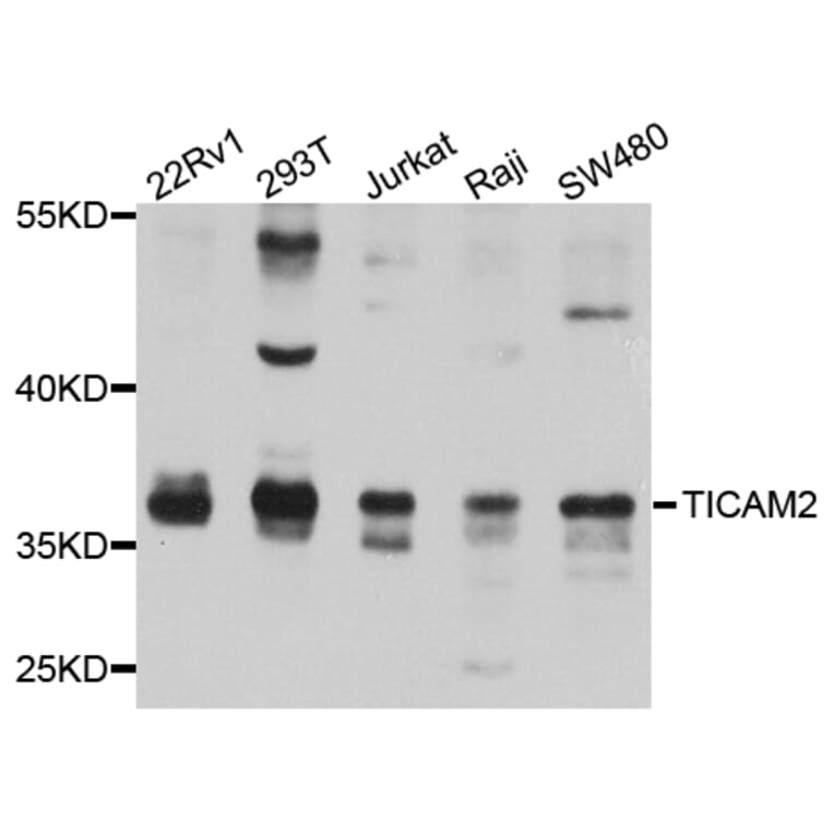 Western Blot - Anti-TICAM2 Antibody (A8292) - Antibodies.com