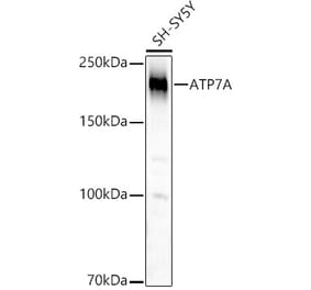 Western Blot - Anti-ATP7A Antibody (A16933) - Antibodies.com