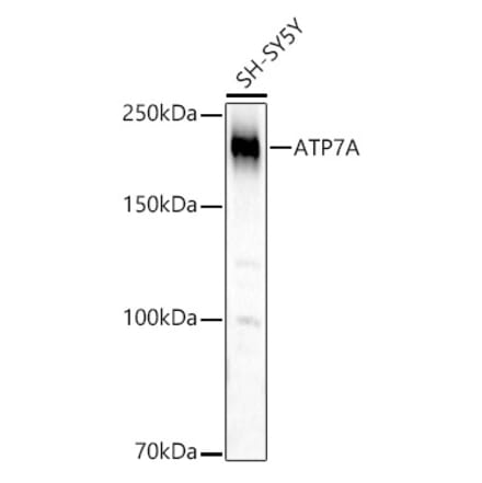 Western Blot - Anti-ATP7A Antibody (A16933) - Antibodies.com