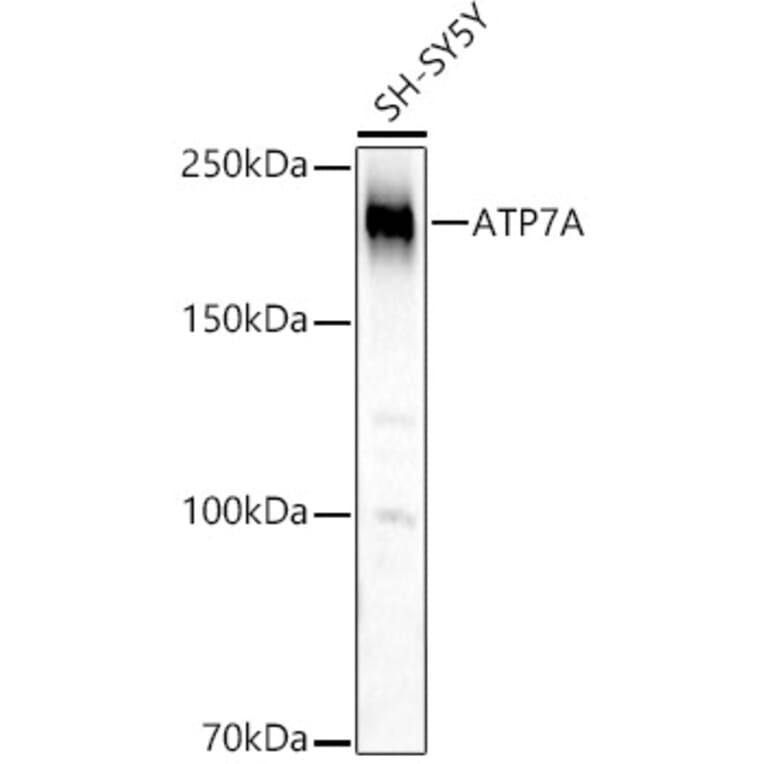 Western Blot - Anti-ATP7A Antibody (A16933) - Antibodies.com