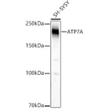 Western Blot - Anti-ATP7A Antibody (A16933) - Antibodies.com