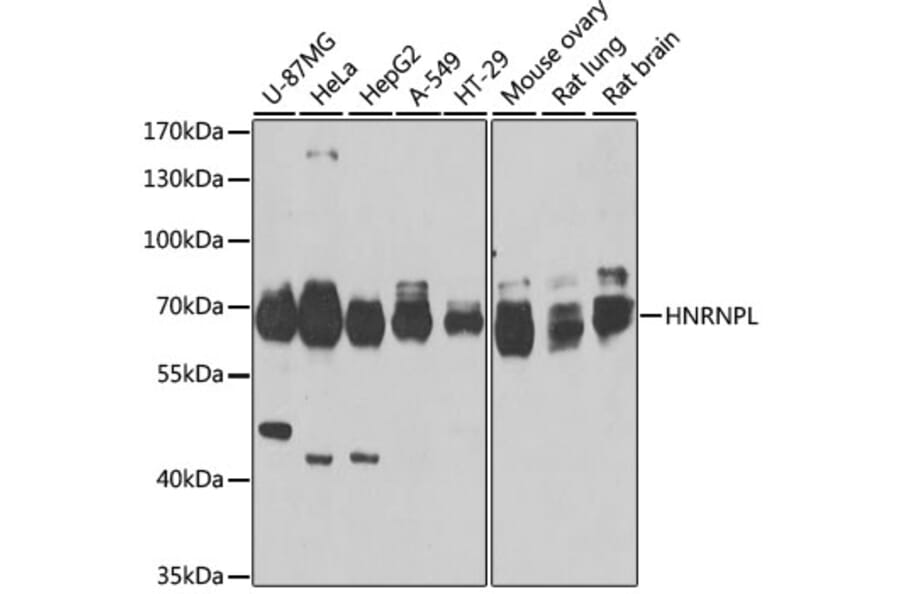Western Blot - Anti-hnRNP L Antibody (A16934) - Antibodies.com