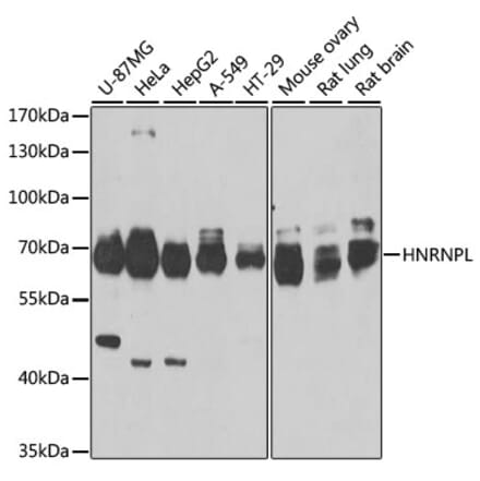 Western Blot - Anti-hnRNP L Antibody (A16934) - Antibodies.com