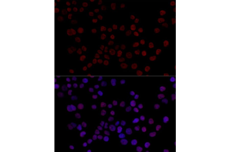 Immunofluorescence - Anti-hnRNP L Antibody (A16934) - Antibodies.com