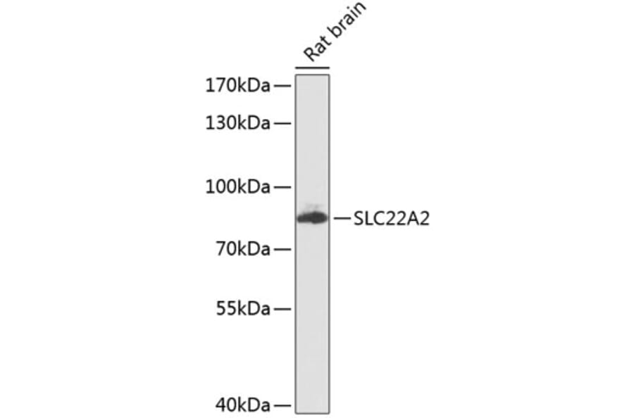 Western Blot - Anti-SLC22A2 Antibody (A16935) - Antibodies.com