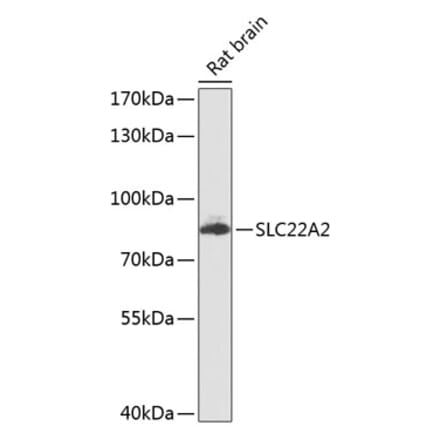 Western Blot - Anti-SLC22A2 Antibody (A16935) - Antibodies.com