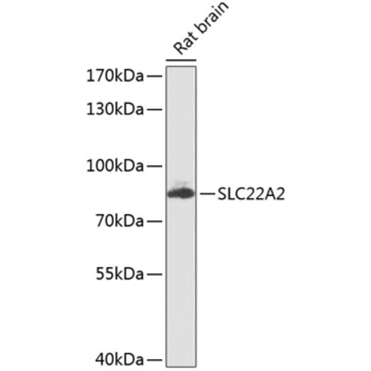 Western Blot - Anti-SLC22A2 Antibody (A16935) - Antibodies.com