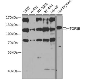 Western Blot - Anti-TOP3B Antibody (A16936) - Antibodies.com