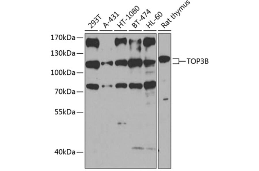 Western Blot - Anti-TOP3B Antibody (A16936) - Antibodies.com