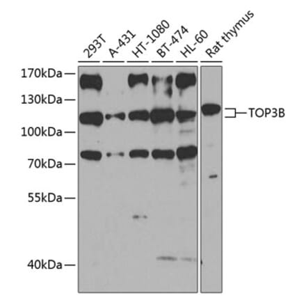 Western Blot - Anti-TOP3B Antibody (A16936) - Antibodies.com