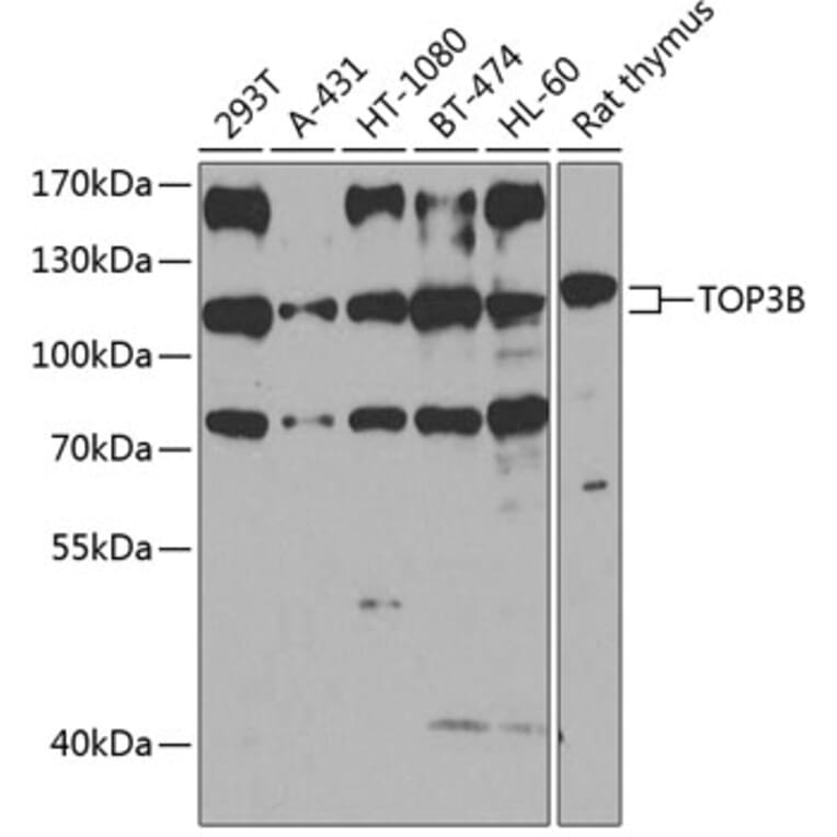 Western Blot - Anti-TOP3B Antibody (A16936) - Antibodies.com