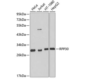 Western Blot - Anti-RPP30 Antibody (A16937) - Antibodies.com