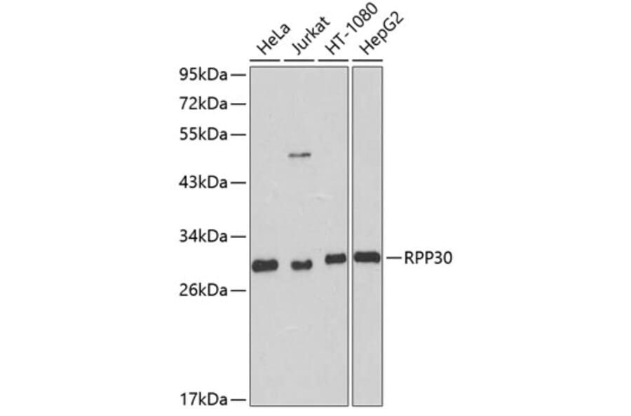 Western Blot - Anti-RPP30 Antibody (A16937) - Antibodies.com
