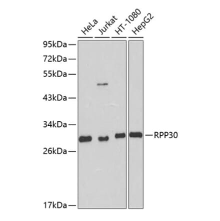 Western Blot - Anti-RPP30 Antibody (A16937) - Antibodies.com