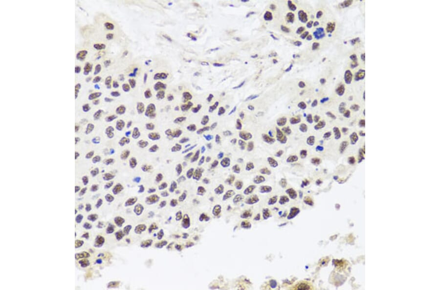 Immunohistochemistry - Anti-RPP30 Antibody (A16937) - Antibodies.com