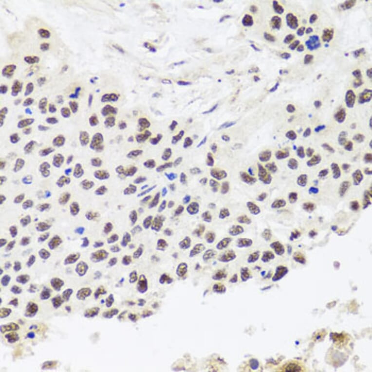 Immunohistochemistry - Anti-RPP30 Antibody (A16937) - Antibodies.com