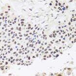 Immunohistochemistry - Anti-RPP30 Antibody (A16937) - Antibodies.com