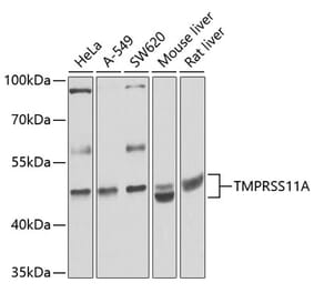 Western Blot - Anti-HESP Antibody (A16939) - Antibodies.com