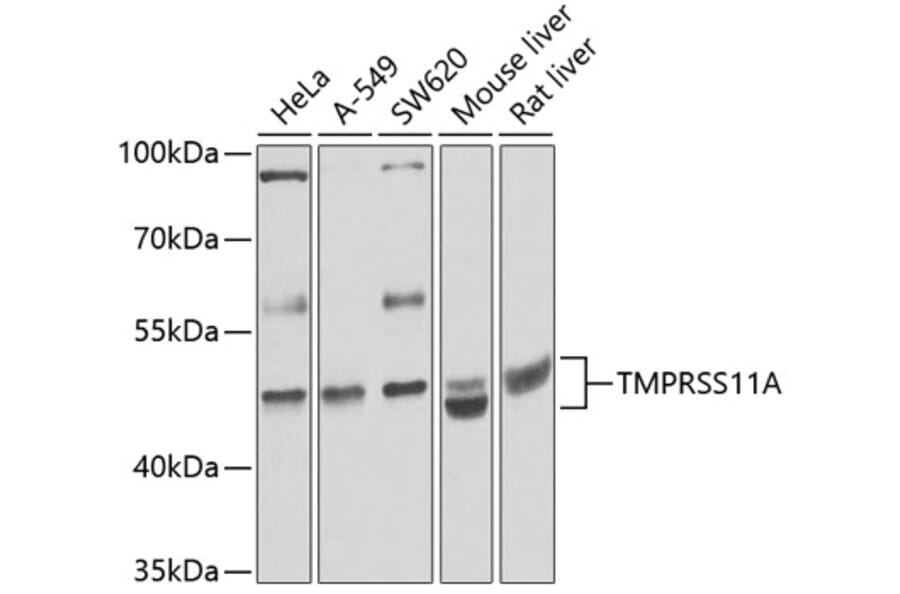 Western Blot - Anti-HESP Antibody (A16939) - Antibodies.com