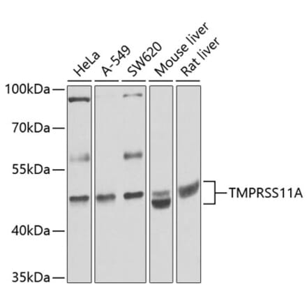 Western Blot - Anti-HESP Antibody (A16939) - Antibodies.com