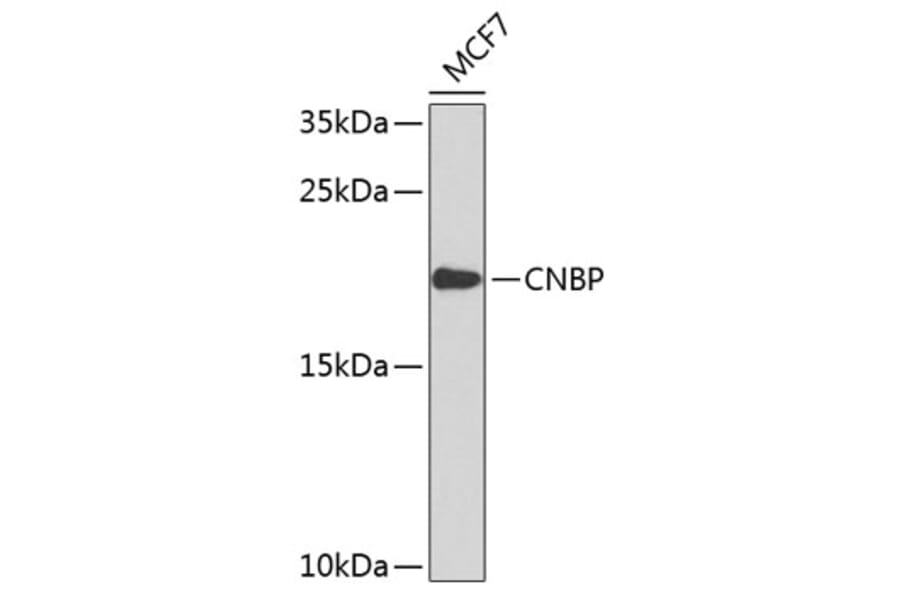 Western Blot - Anti-CNBP Antibody (A9034) - Antibodies.com