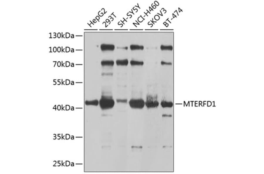 Western Blot - Anti-MTERFD1/MTERF3 Antibody (A16944) - Antibodies.com