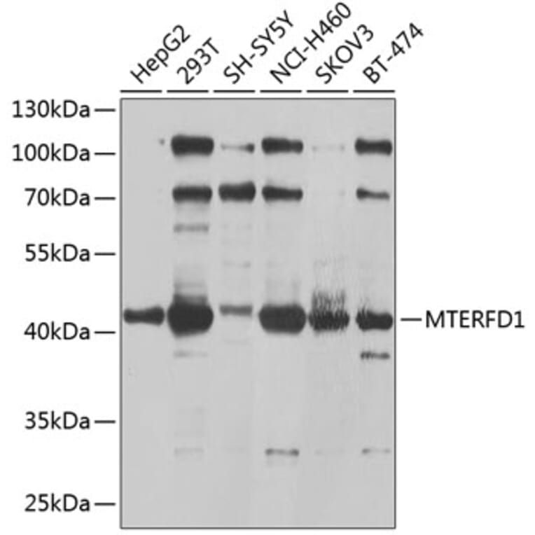 Western Blot - Anti-MTERFD1/MTERF3 Antibody (A16944) - Antibodies.com