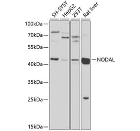Western Blot - Anti-Nodal Antibody (A16945) - Antibodies.com