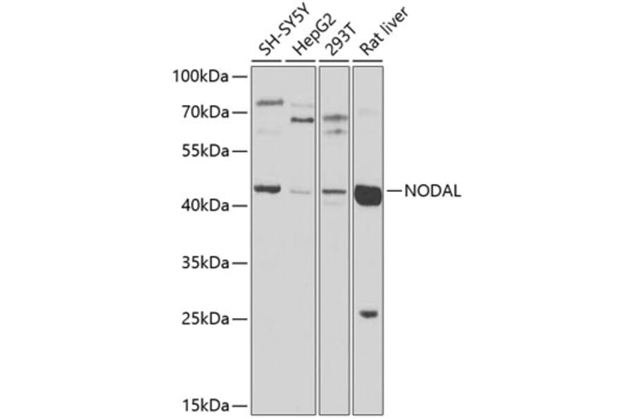 Western Blot - Anti-Nodal Antibody (A16945) - Antibodies.com