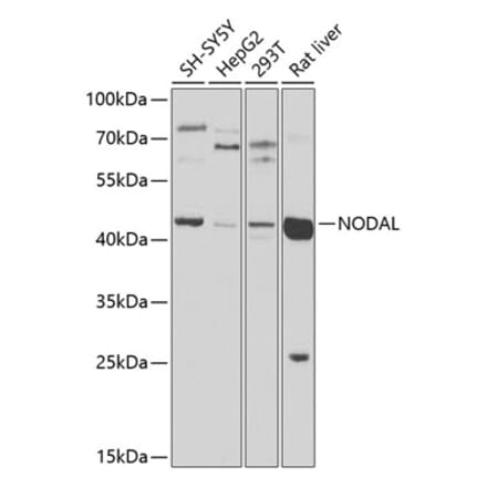 Western Blot - Anti-Nodal Antibody (A16945) - Antibodies.com