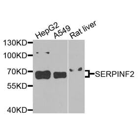 Western Blot - Anti-SERPINF2 Antibody (A9945) - Antibodies.com
