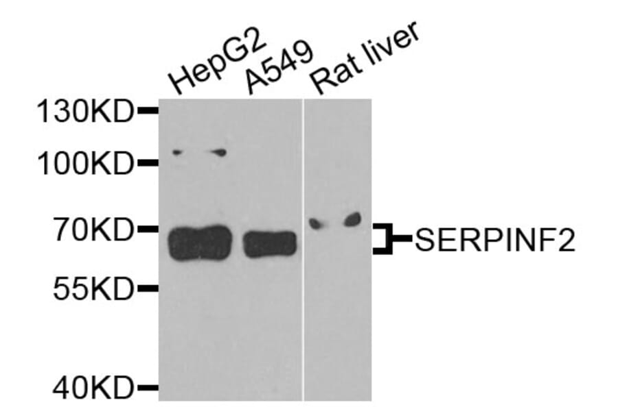 Western Blot - Anti-SERPINF2 Antibody (A9945) - Antibodies.com