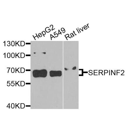 Western Blot - Anti-SERPINF2 Antibody (A9945) - Antibodies.com