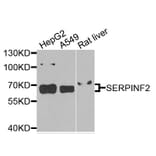 Western Blot - Anti-SERPINF2 Antibody (A9945) - Antibodies.com