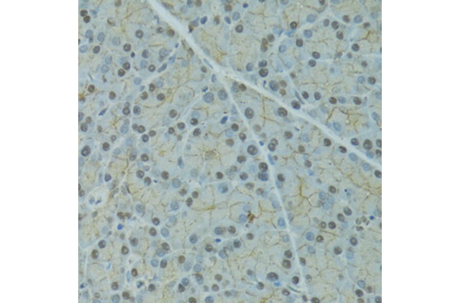 Immunohistochemistry - Anti-SERPINF2 Antibody (A9945) - Antibodies.com