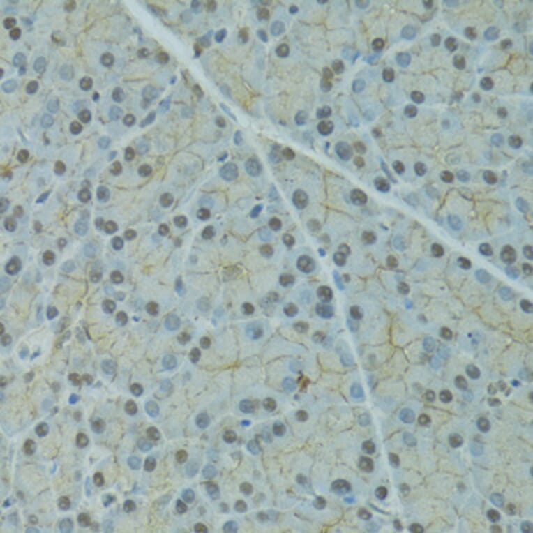 Immunohistochemistry - Anti-SERPINF2 Antibody (A9945) - Antibodies.com