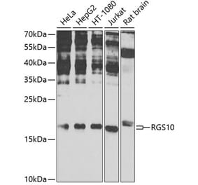 Western Blot - Anti-RGS10 Antibody (A16947) - Antibodies.com