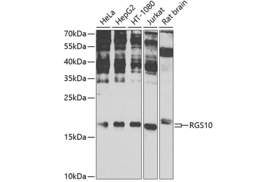 Western Blot - Anti-RGS10 Antibody (A16947) - Antibodies.com