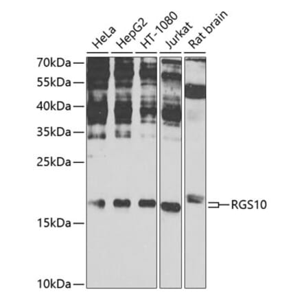 Western Blot - Anti-RGS10 Antibody (A16947) - Antibodies.com